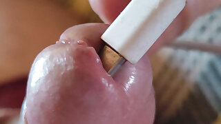 Applying Electric Shocks Inside the Glans.